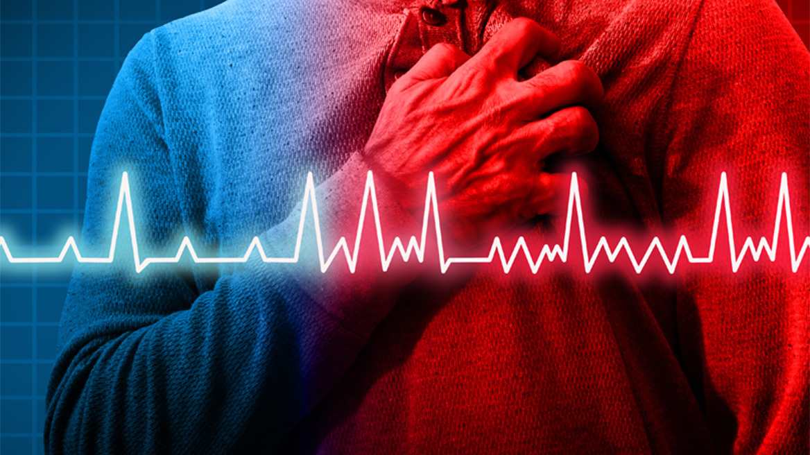 Κολπική μαρμαρυγή: Τι είναι και πώς αντιμετωπίζεται;