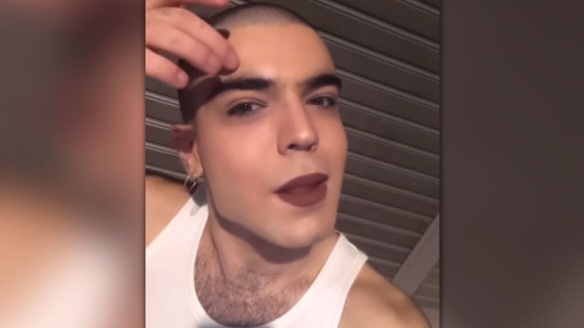 Ομοφοβική επίθεση: Mοντέλο καταγγέλλει - Έσβησε τσιγάρο πάνω μου, θα γίνω άλλος ένας Ζακ Κωστόπουλος