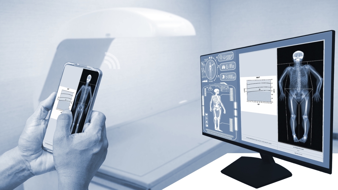 Σε ποια ηλικία πρέπει να γίνεται η εξέταση για την οστεοπόρωση