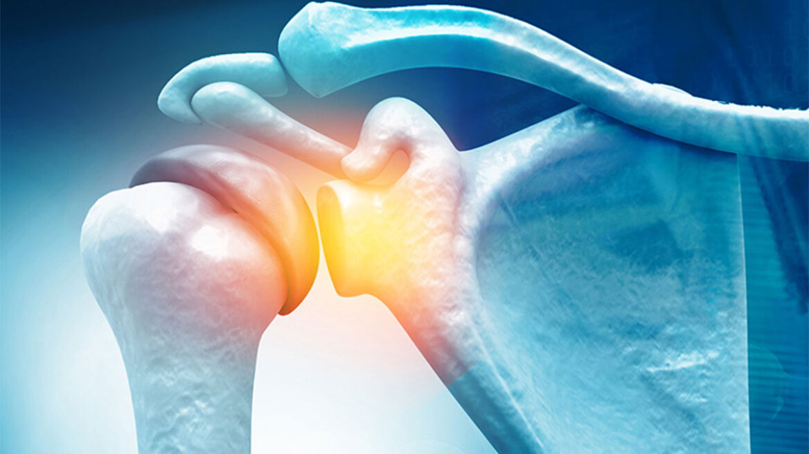 Αρθροσκόπηση Ώμου: Πώς επιδιορθώνονται οι ρήξεις;