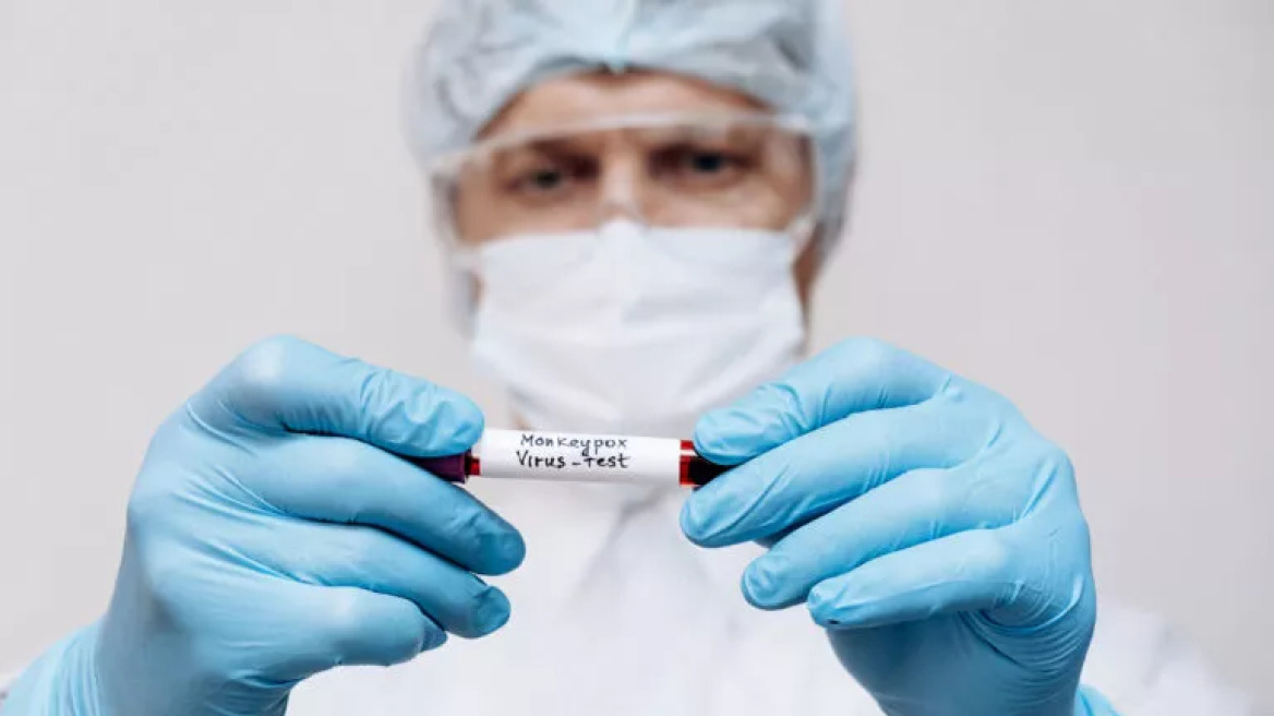 Ευλογιά των πιθήκων: «Έκρηξη» κρουσμάτων 660% – 5 χώρες στο κόκκινο – Η κατάσταση στην Ελλάδα