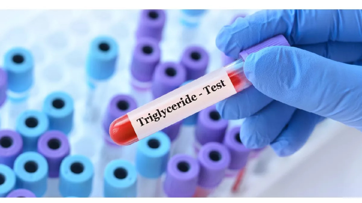 Τριγλυκερίδια: Νέο φάρμακο μειώνει κατά 50% τις υψηλές τιμές τους
