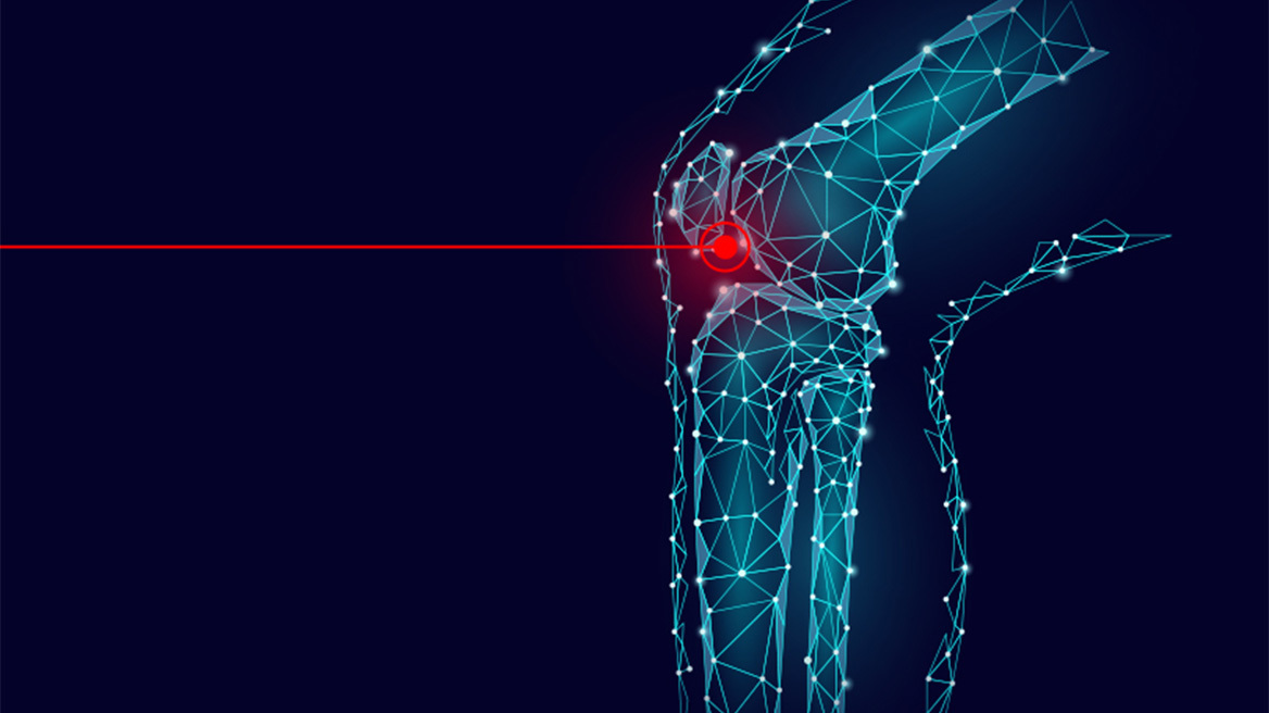 Πόνος στο γόνατο; Πότε χρειάζεται αρθροπλαστική;