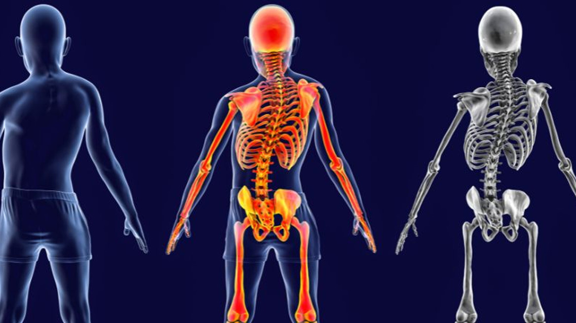 Σπονδυλική Στήλη: Αντιμετώπιση παραμορφώσεων με χειρουργική πλοήγηση