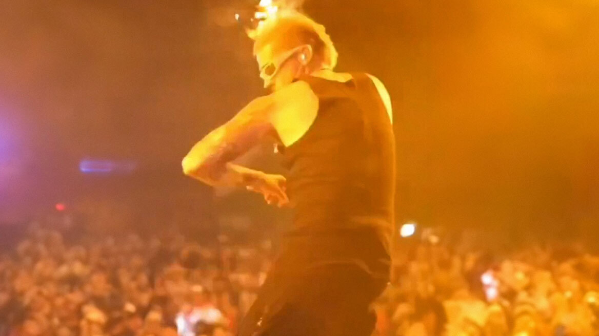 Κολομβία: Τρόμος για τραγουδιστή όταν έπιασαν φωτιά τα μαλλιά του σε συναυλία
