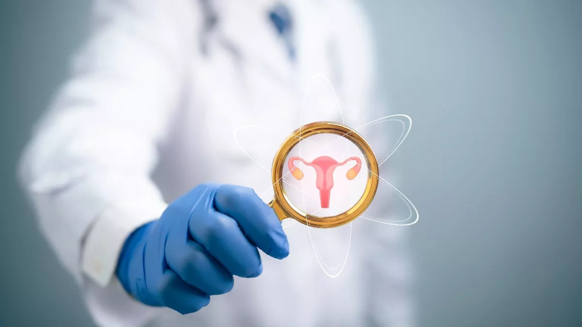 Καρκίνος τραχήλου μήτρας: Νεότερες εξελίξεις στην πρόληψη και αντιμετώπιση της νόσου