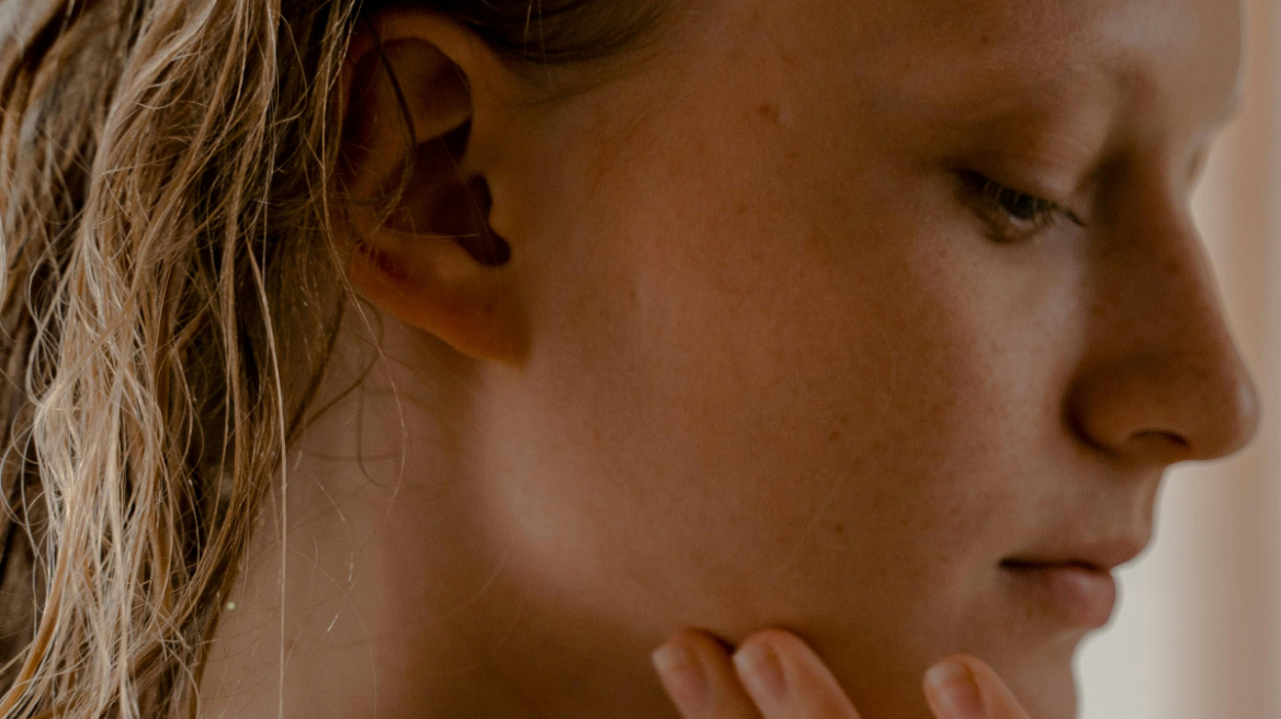 Τέσσερις συνήθειες που ίσως ευθύνονται για την εμφάνιση ακμής στην επιδερμίδα σας