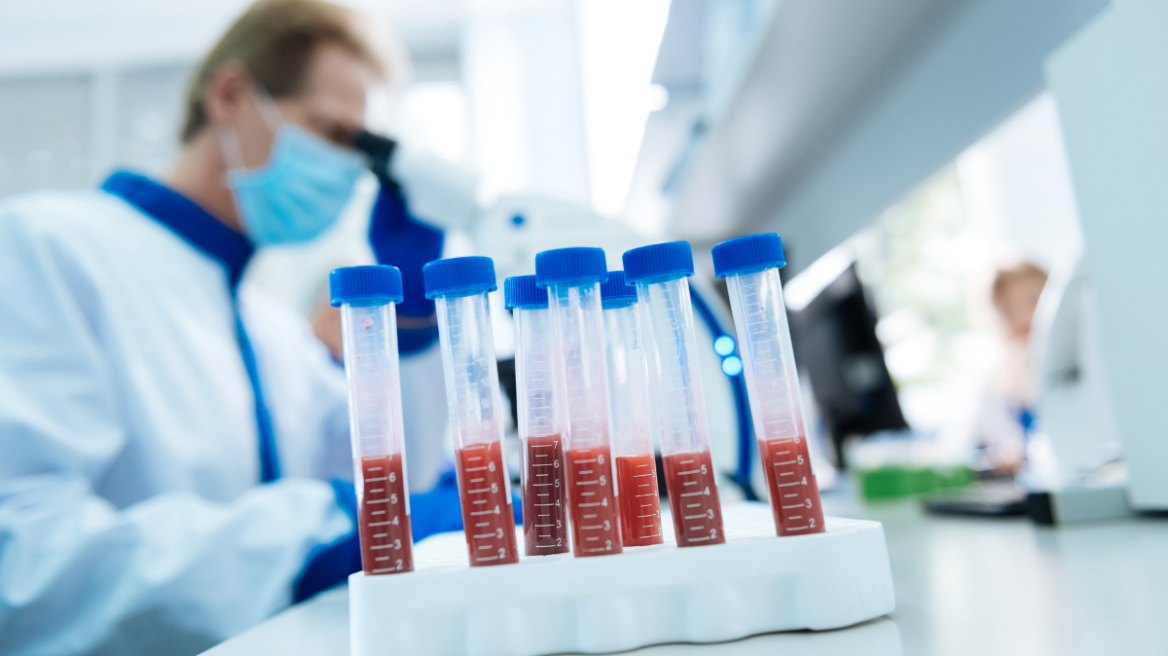 Καρκίνος Παχέος Εντέρου: Εγκρίθηκε νέο τεστ αίματος που τον ανιχνεύει με ακρίβεια έως 83% 