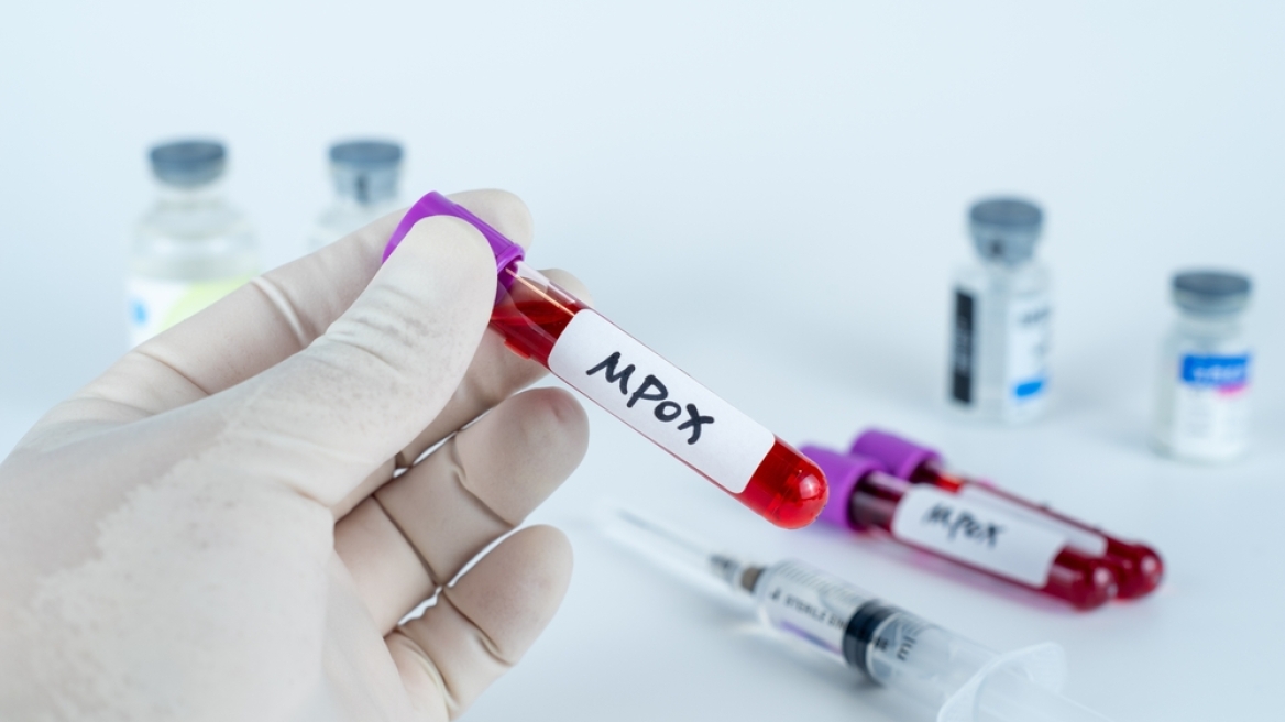 Ευλογιά των πιθήκων - mpox: Καταγράφηκε κρούσμα στην Ταϊλάνδη