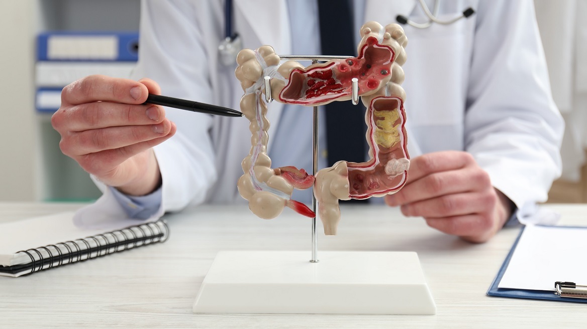 Γαστρεντερολογία και τεχνητή νοημοσύνη