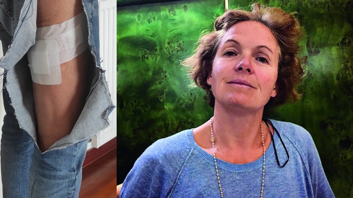 Βουλιαγμένη: «Εξαφανίστηκε και δεν μου ζήτησε ούτε συγγνώμη» είπε ο άνδρας που τον δάγκωσε το σκυλί της μητέρας Τσιτσιπά