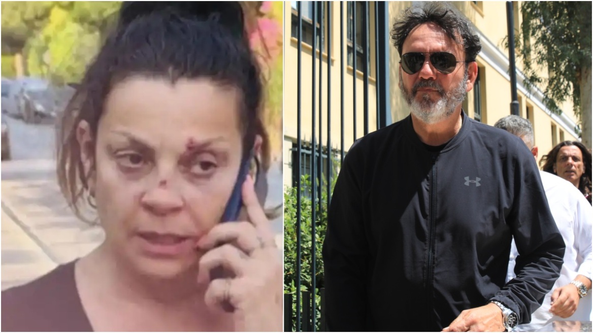 Στάθης Αγγελόπουλος: Έχουμε τσακωθεί πολλές φορές, τον είχα χαστουκίσει, γιατί με έδειρε, υποστήριξε η πρώην σύζυγός του