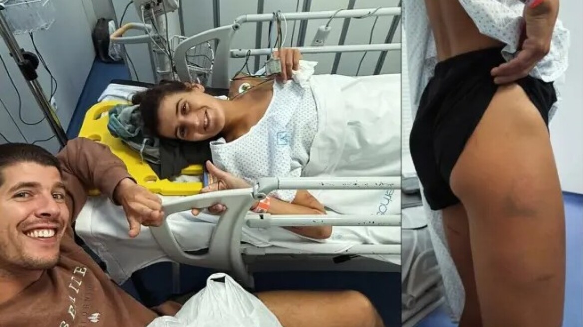 Ισπανία: Αγελάδα επιτέθηκε και τραυμάτισε σοβαρά γυναίκα μαραθωνοδρόμο