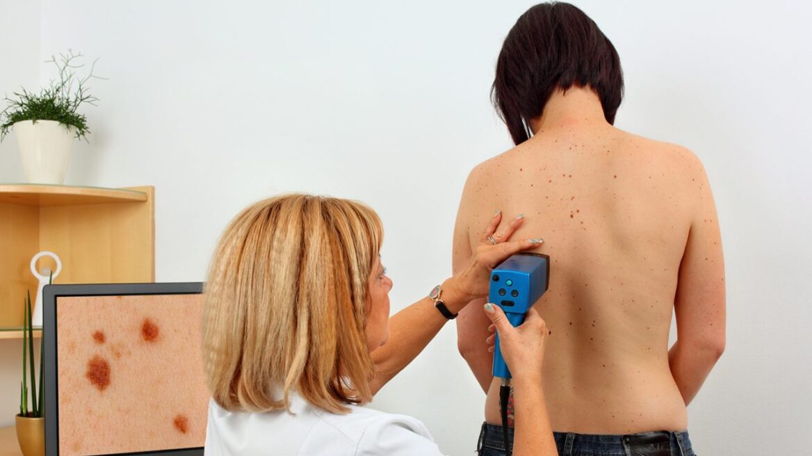 Ασφαλιστήριο – Αποζημίωση: Οι καλύψεις για το μελάνωμα