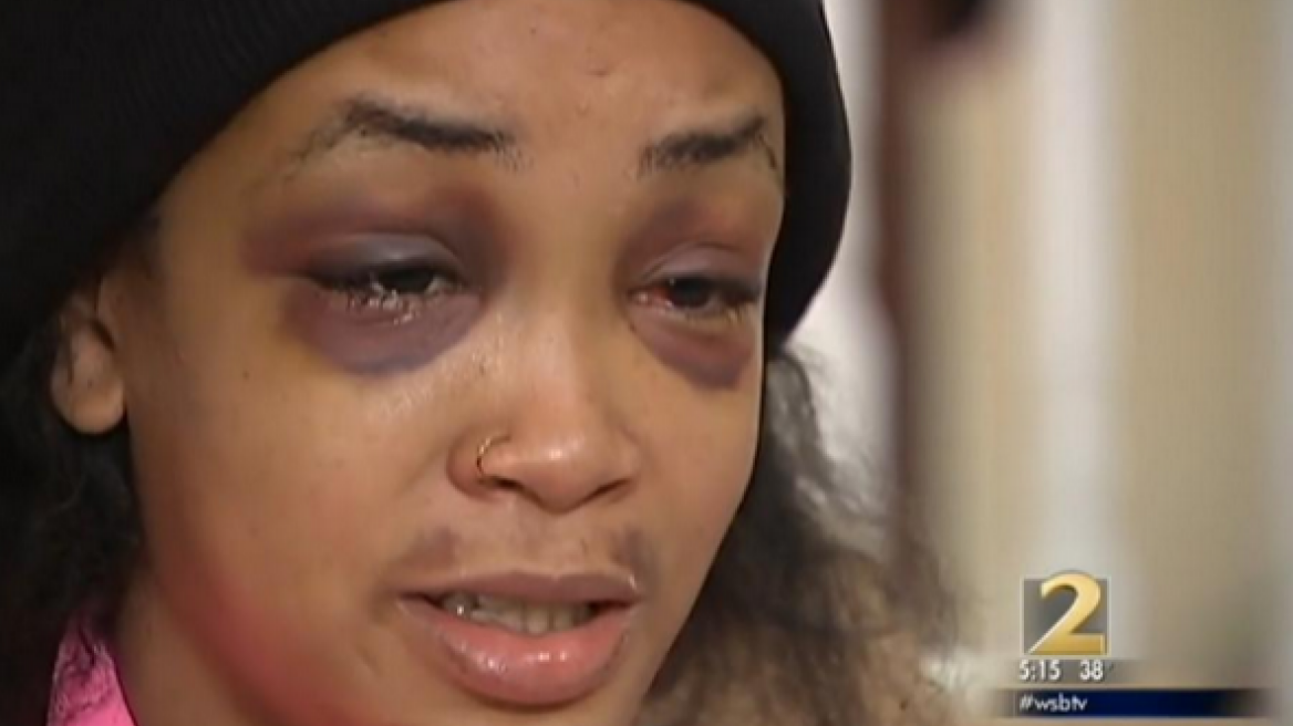 ΗΠΑ: Γρονθοκόπησαν γυναίκα για ένα χάμπουργκερ!