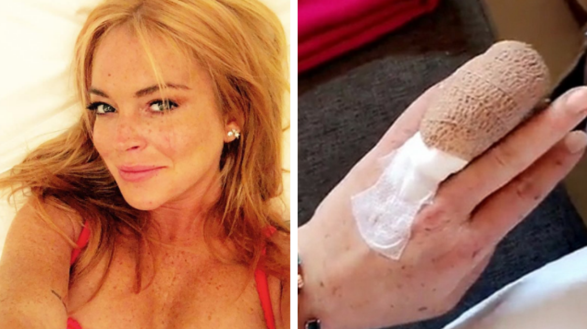 Λίντσεϊ Λόχαν: Επείγουσα εγχείρηση για να σώσει το δάχτυλό της μετά από ατύχημα