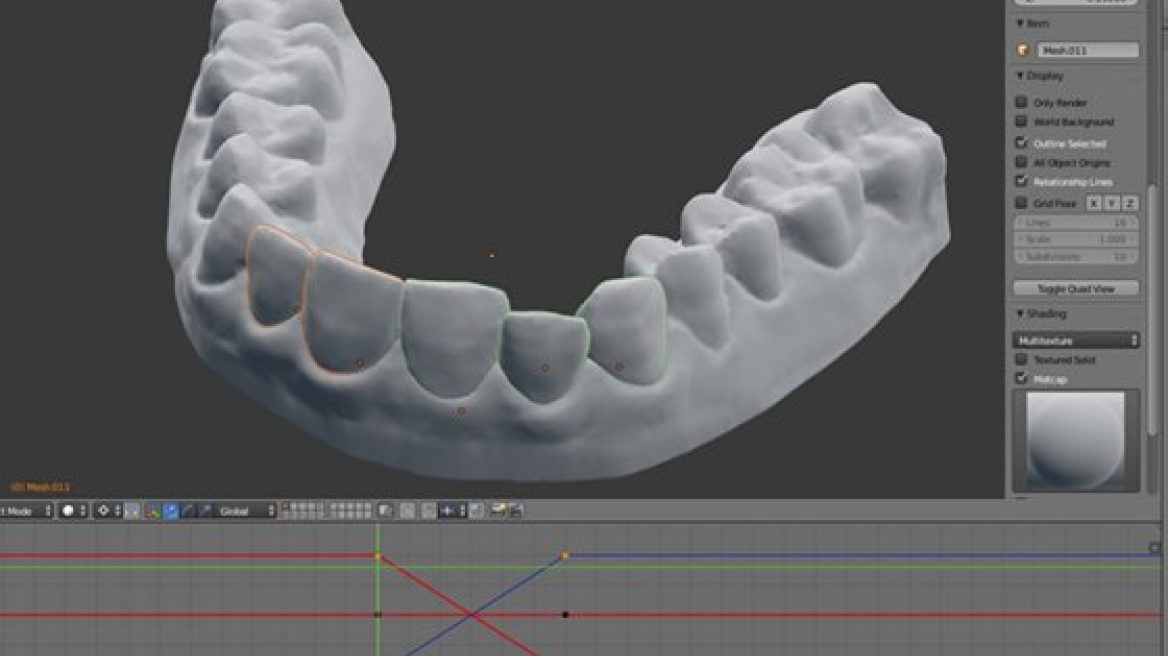 He made his own 3D printed teeth and saved thousands $! (photos)