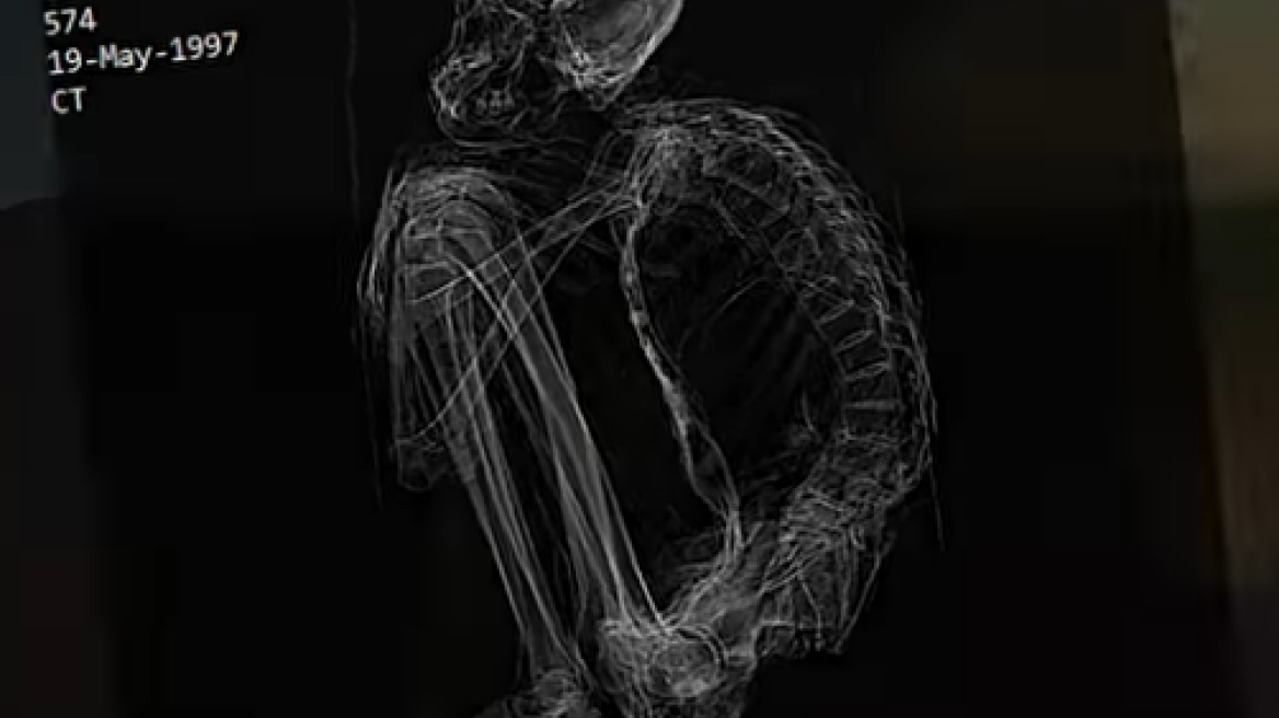  There are aliens and there are these mummified Peruvian “aliens”! (VIDEOS)