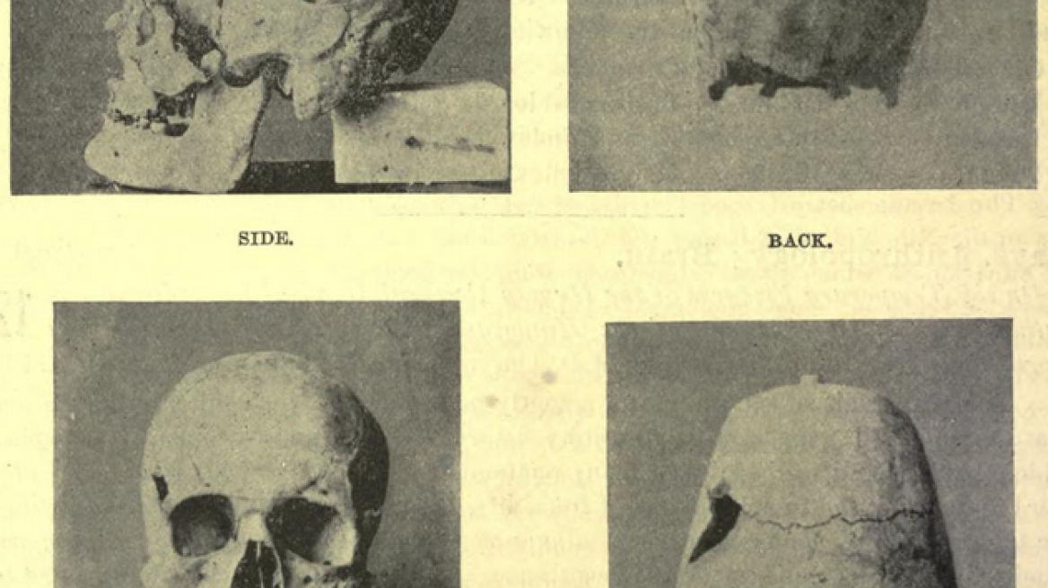 Ancient Egyptian Pharaoh is world’s oldest case of gigantism
