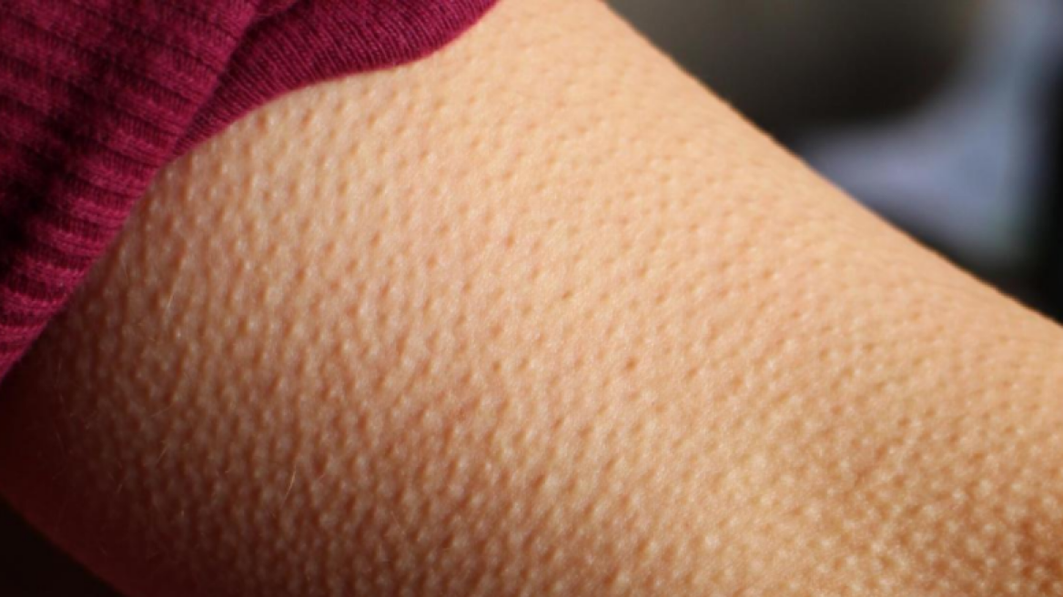 If music gives you goosebumps, your brain might be special