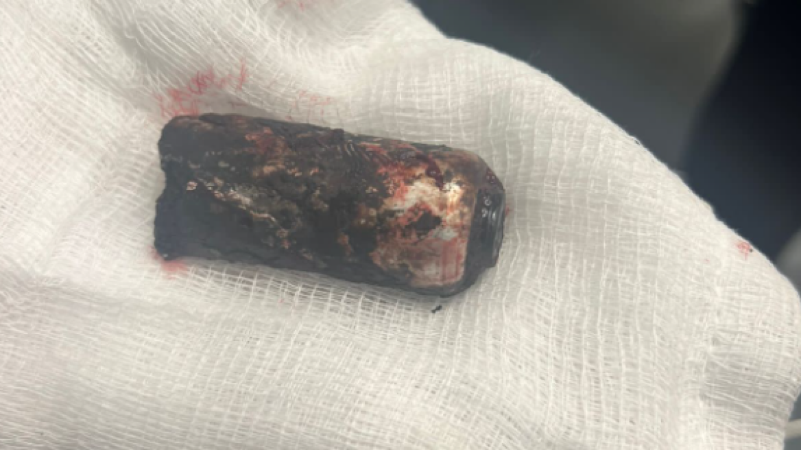 Η ναυτική φωτοβολίδα που τραυμάτισε τον αστυνομικό στα επεισόδια με τους χούλιγκαν στου Ρέντη - Φωτογραφία