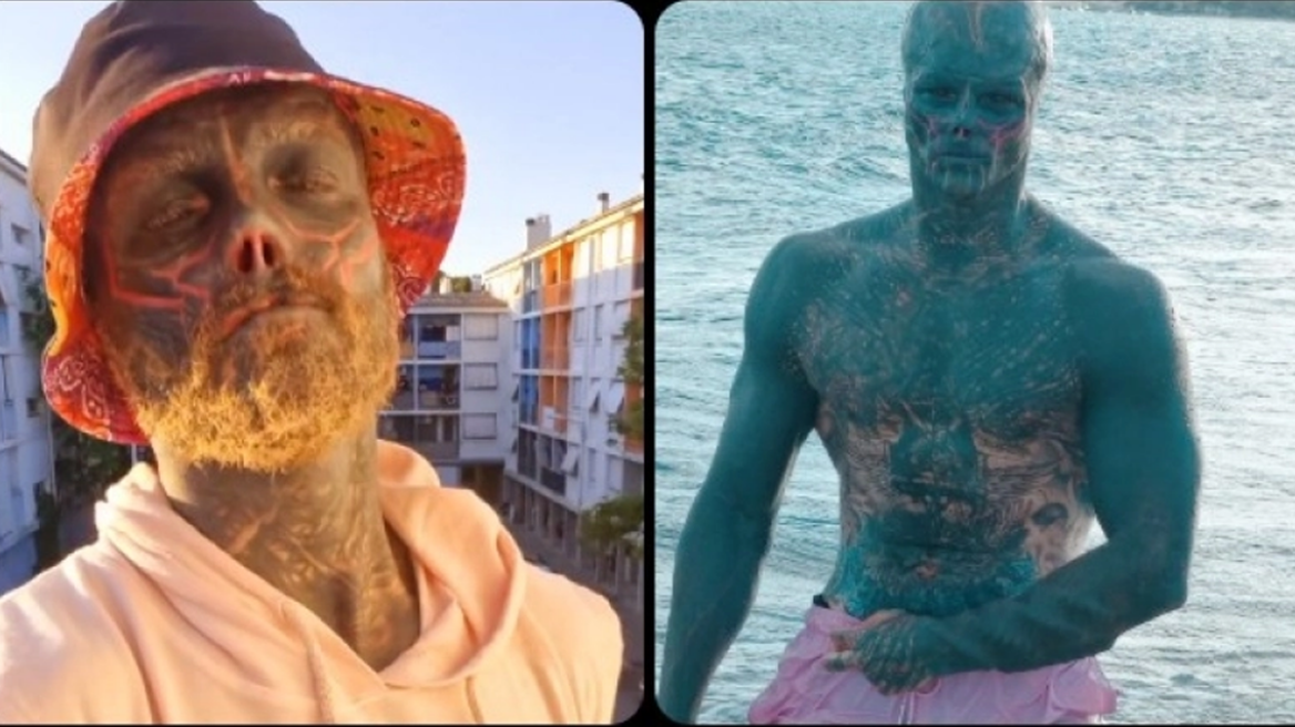 Έκοψε τα δάχτυλα και τα αυτιά του για να γίνει... εξωγήινος και αποκαλύπτει τι ακούει καθημερινά