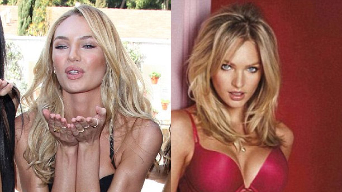 Αποστεωμένη η Candice Swanepoel 