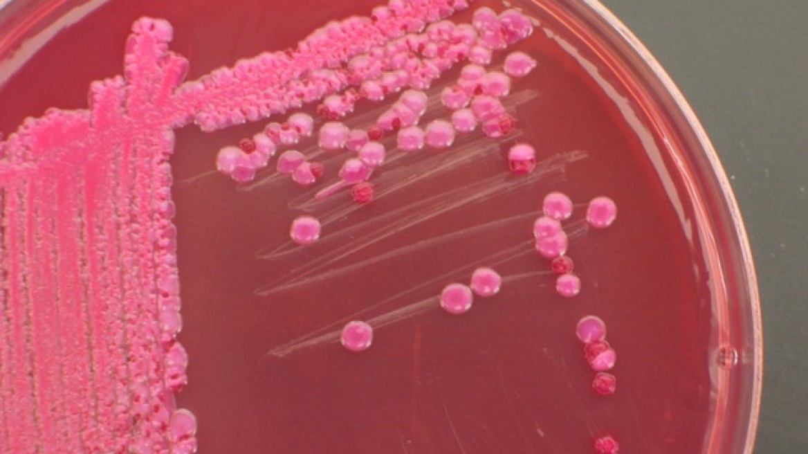 Άκρως τοξικό το θανατηφόρο βακτήριο E.coli