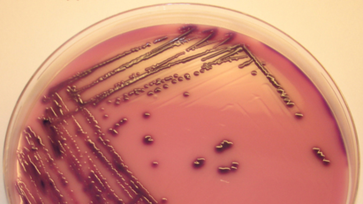 Δύο κρούσματα άμεσης μετάδοσης του E.coli στη Δανία
