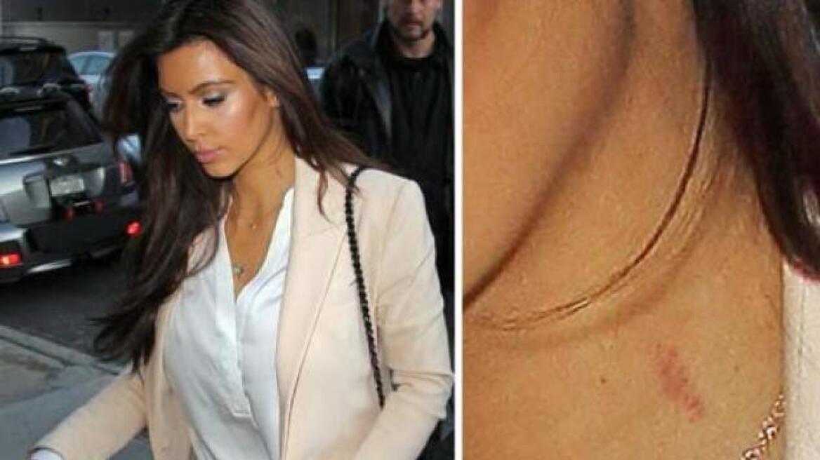 Kim Kardashian: Μα το σημάδι στο λαιμό της απ' τα φιλιά του...