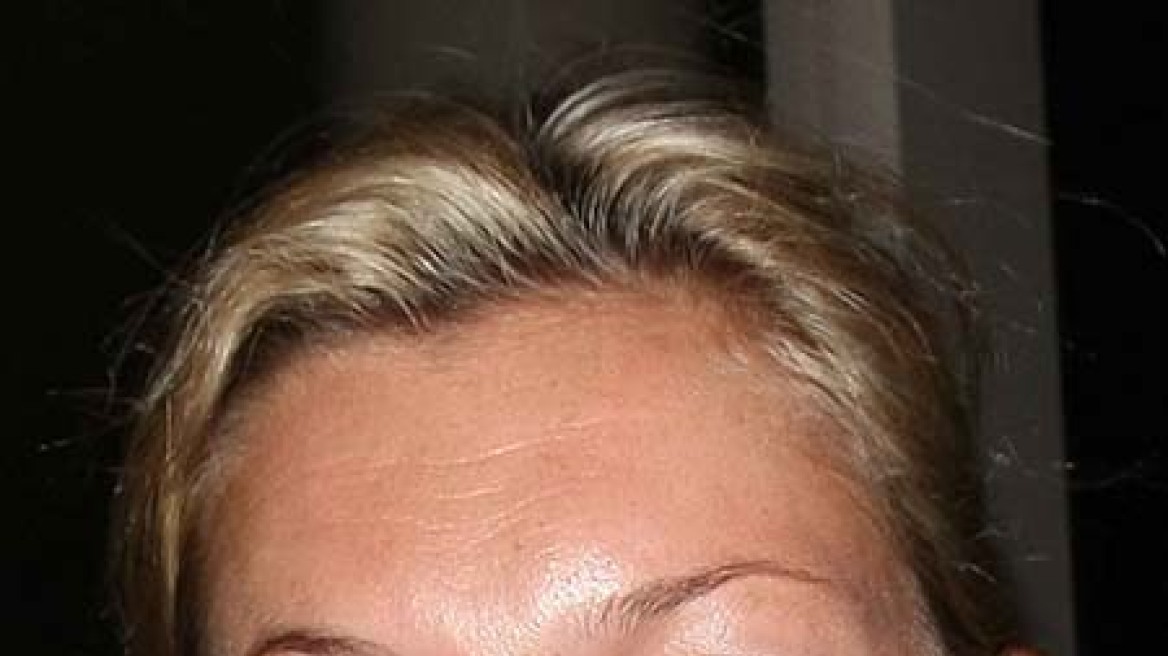 Χάλια χωρίς make-up η Kate Moss