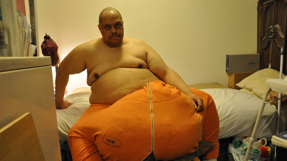 «Έκοψε» τους βάρους 60 κιλών όρχεις του και «απέκτησε» πέος ενός εκατοστού!