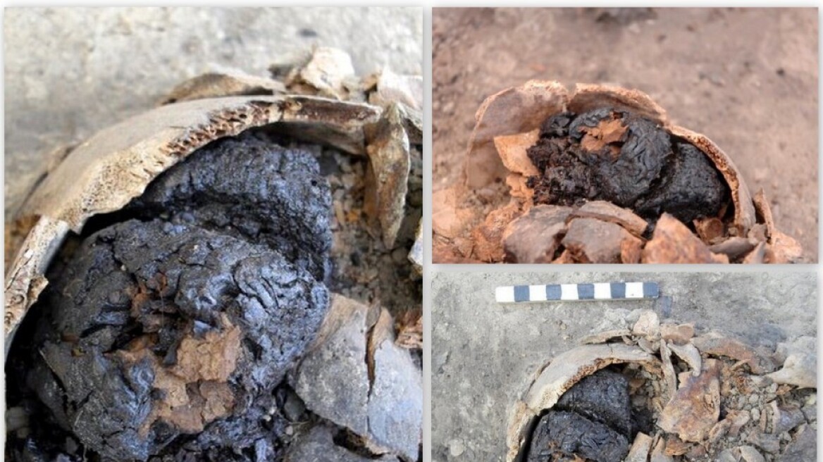 Ανθρώπινος εγκέφαλος 4.000 ετών εντοπίστηκε στην Τουρκία