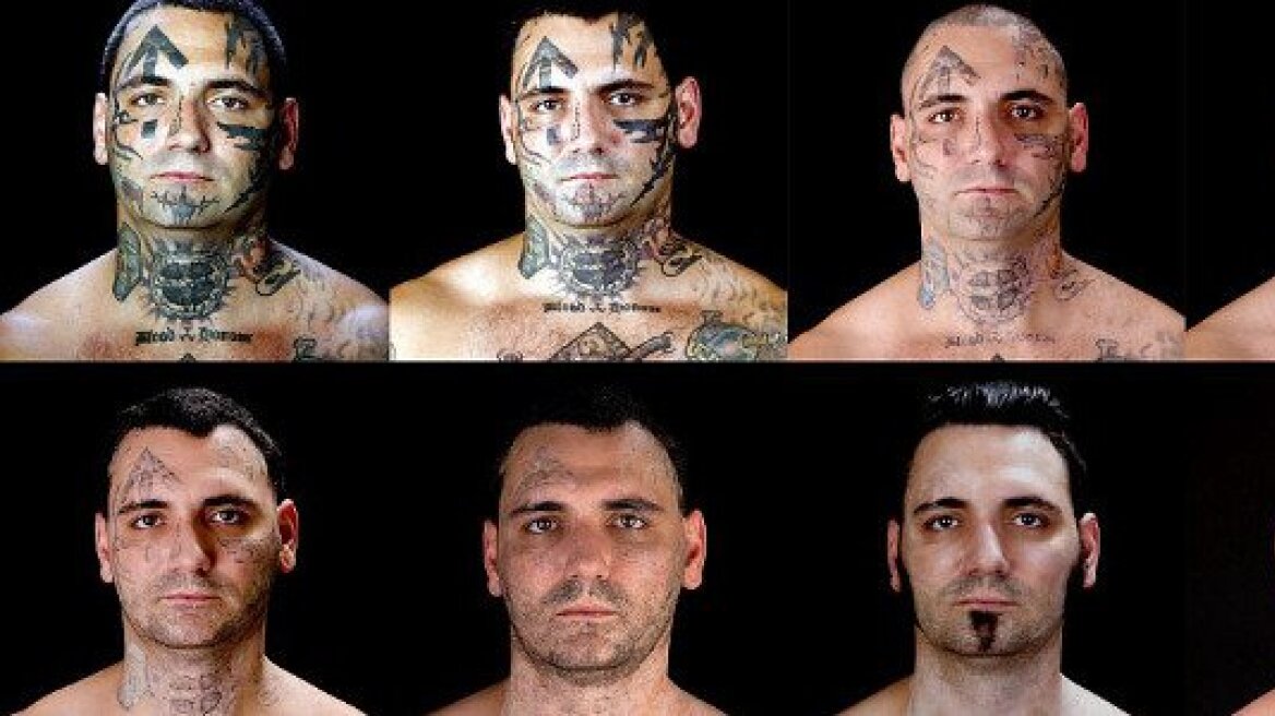Μετανιωμένος ρατσιστής αφαιρεί όλα τα ναζιστικά τατουάζ του!