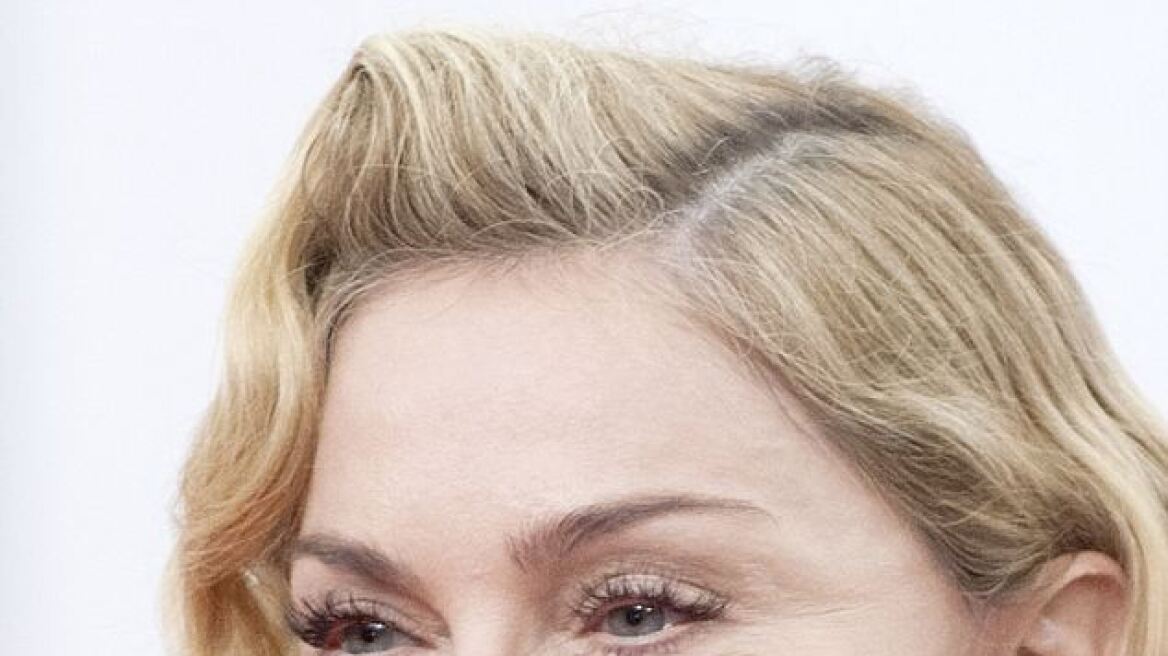 Madonna: Τι έκανε (ξανά) στο πρόσωπό της;