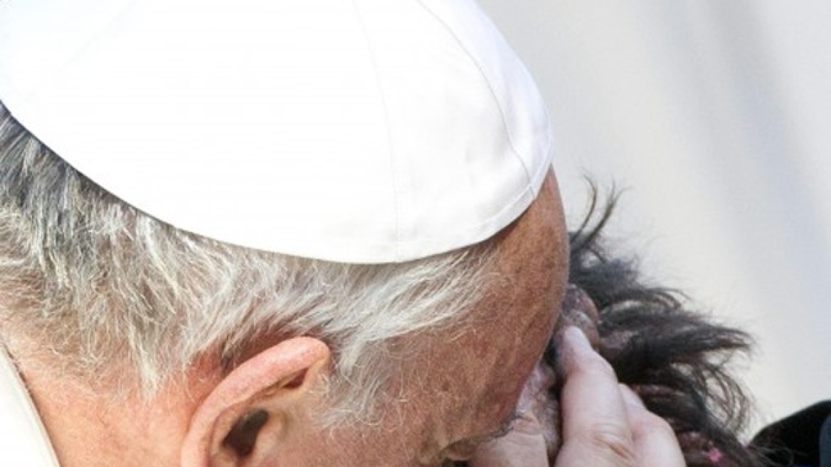 Τι είναι η  νευροϊνωμάτωση από την οποία πάσχει ο «παραμορφωμένος» του Πάπα 