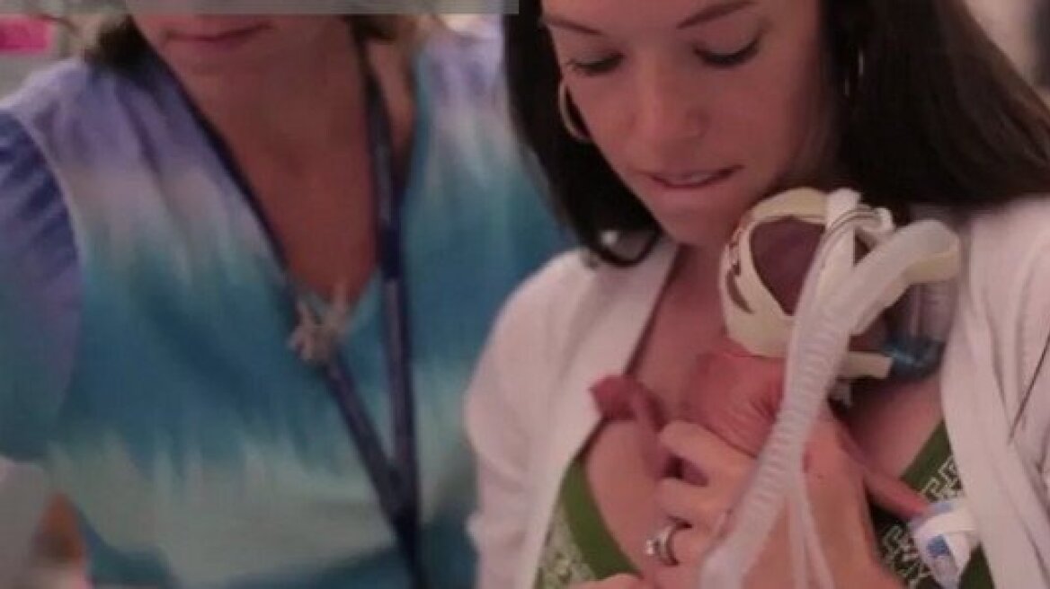 Βίντεο: Η απίστευτη ιστορία ενός μωρού που γεννήθηκε πολύ νωρίς