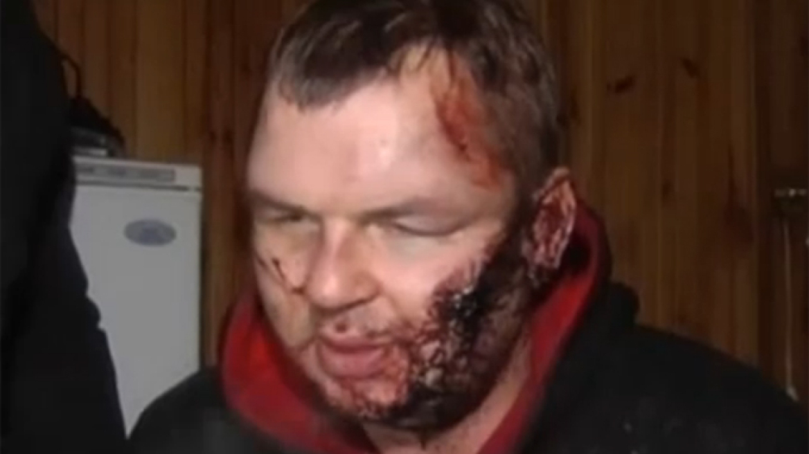 Βίντεο: Σοκ και κατακραυγή για την εικόνα κακοποιημένου Ουκρανού διαδηλωτή 