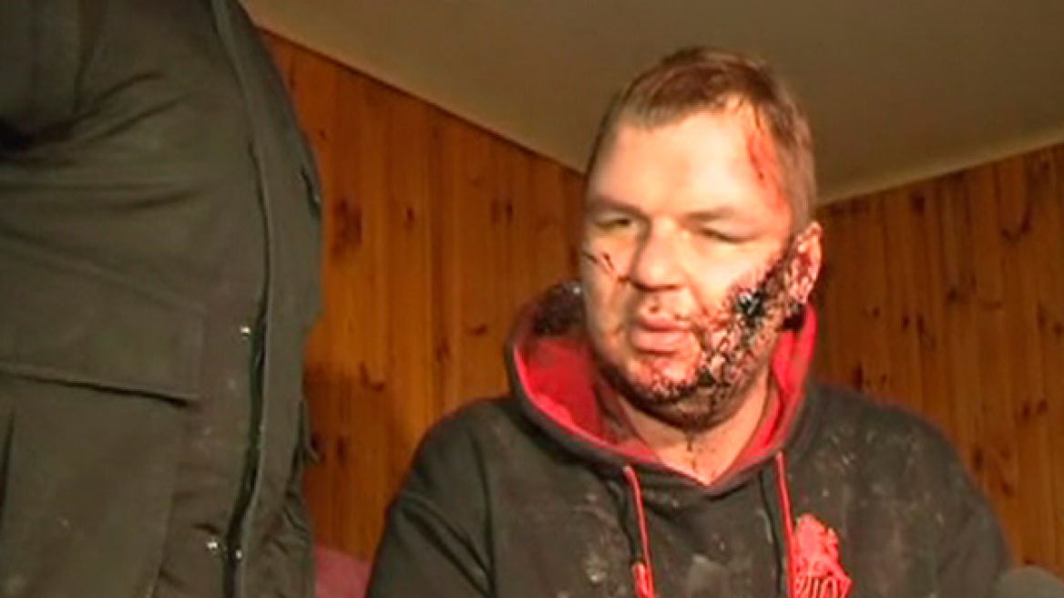 Ουκρανία: Σε κατ 'οίκον περιορισμό ο βασανισμένος ακτιβιστής Μπουλάτοφ