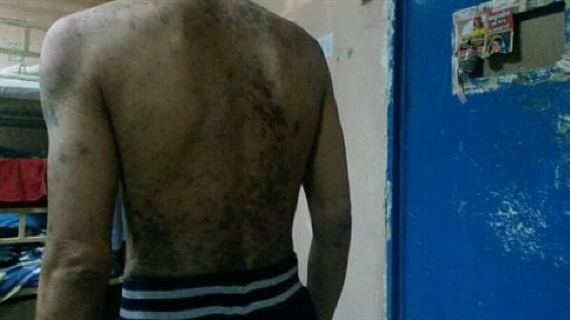 Εικόνες-σοκ μέσα από το νοσοκομείο των φυλακών Κορυδαλλού