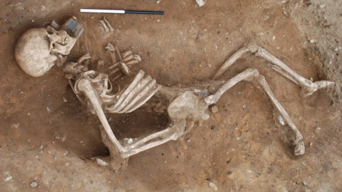 Τα αρχαιότερα σημάδια μεταστατικού καρκίνου σε σκελετό ηλικίας 3.200 ετών 