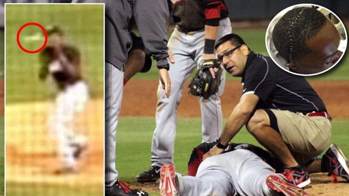 Βίντεο: Τρομακτικός τραυματισμός παίκτη του μπέιζμπολ από μπαλάκι
