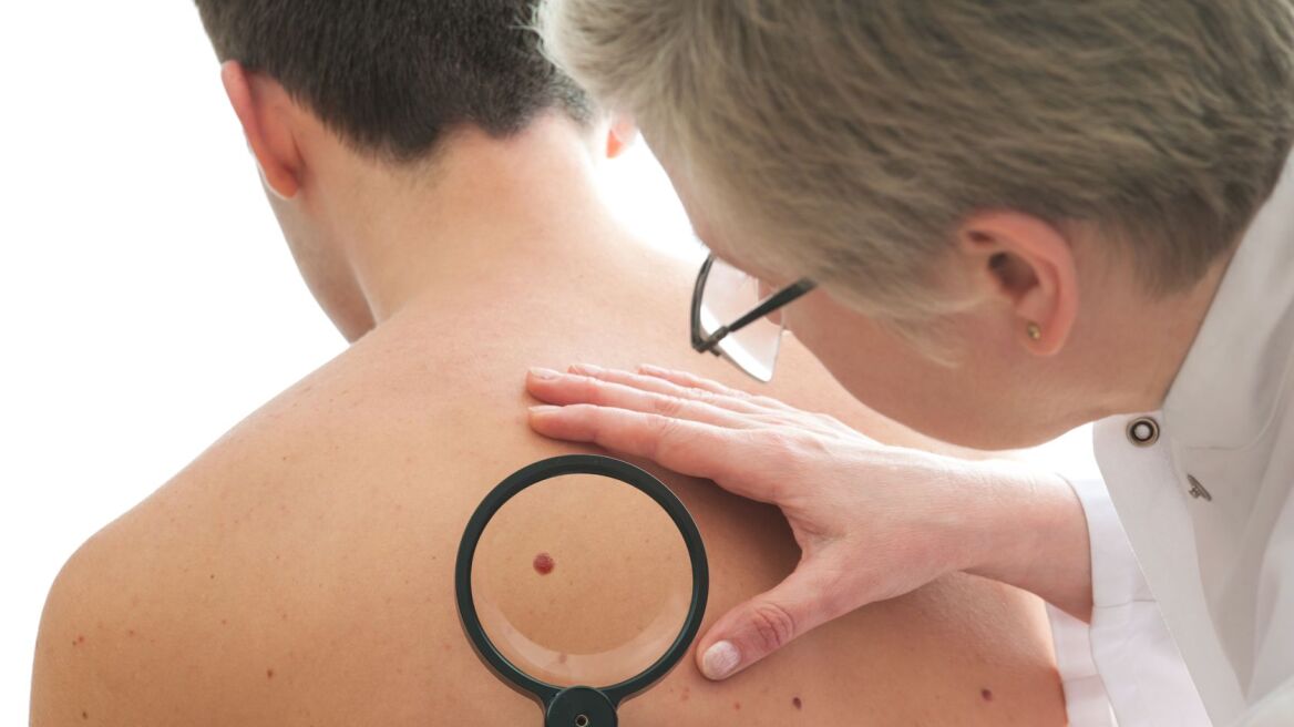 Εξετάσεις στο πλαίσιο της εβδομάδας πρόληψης του καρκίνου του δέρματος 