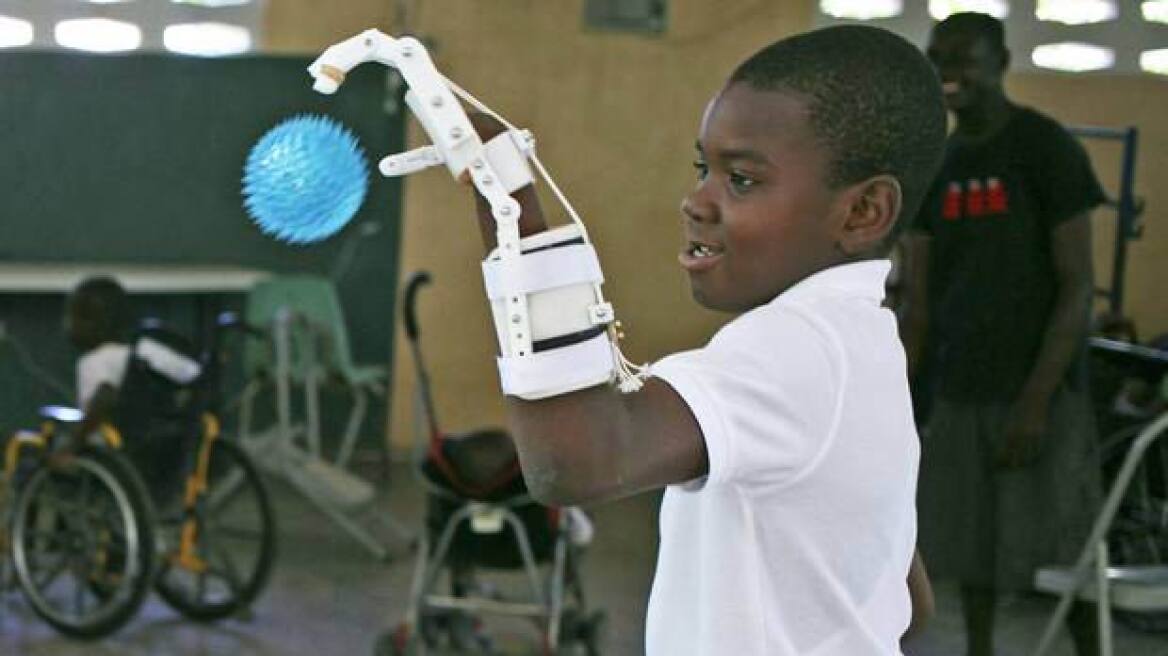 «Θαύμα» της τεχνολογίας: «Νέο» χέρι για ορφανό από την Αϊτή