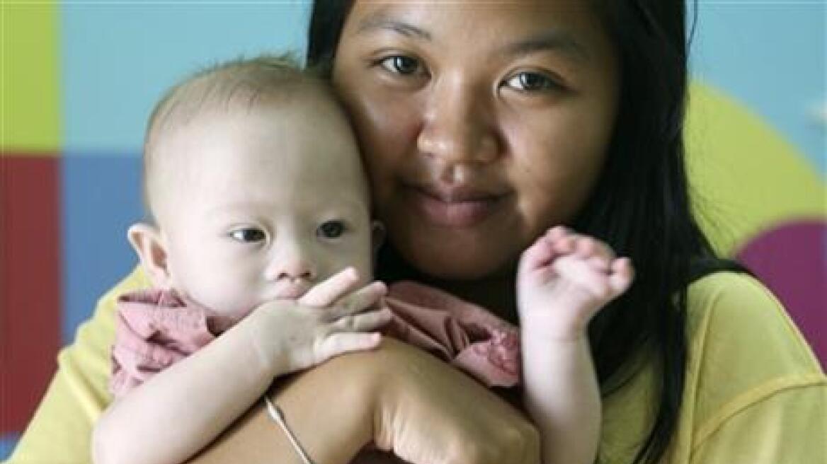 Ζήτησαν από την παρένθετη μητέρα να κάνει έκτρωση στο μωρό με Σύνδρομο Down