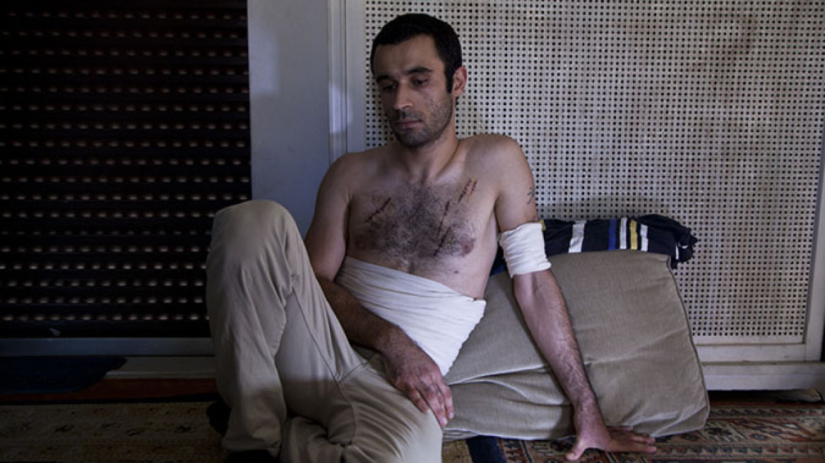 Φωτογραφίες-σοκ: Τον μαχαίρωσαν δώδεκα φορές επειδή είναι από το Ιράν
