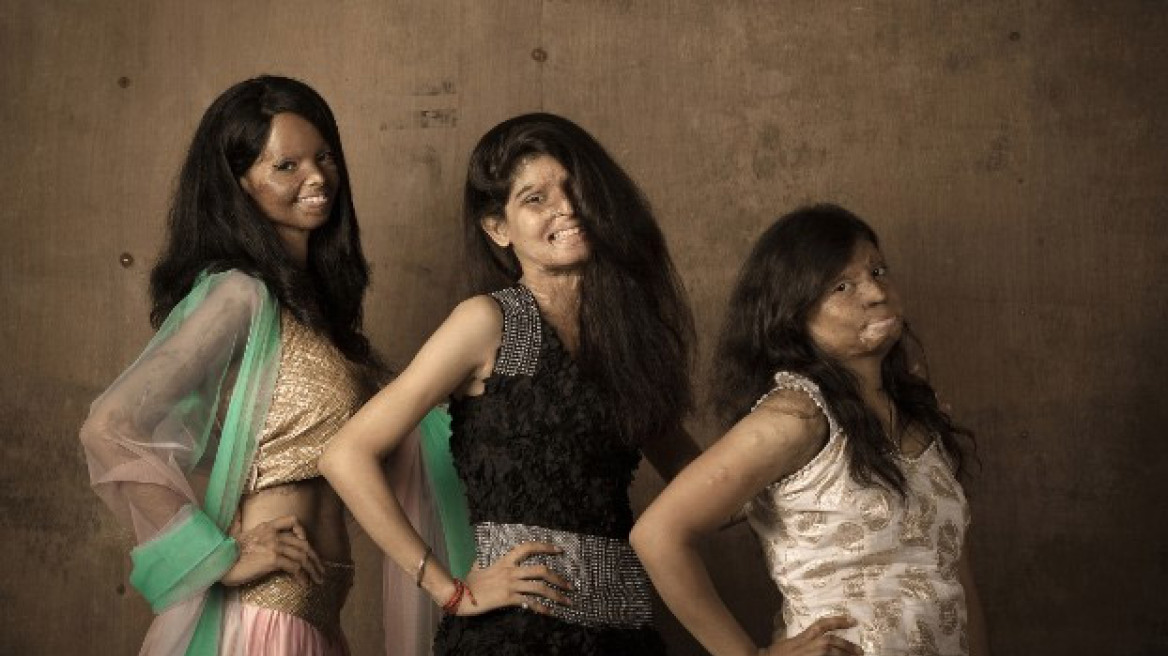 Ινδία: Θύματα επιθέσεων με οξύ σε φωτογράφιση μόδας!