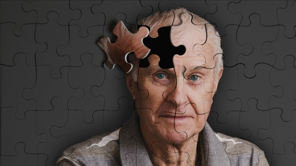 Ελπίδες για εκατομμύρια ανθρώπους: Ερευνητές αποκατέστησαν τη μνήμη ασθενών με Αλτσχάιμερ