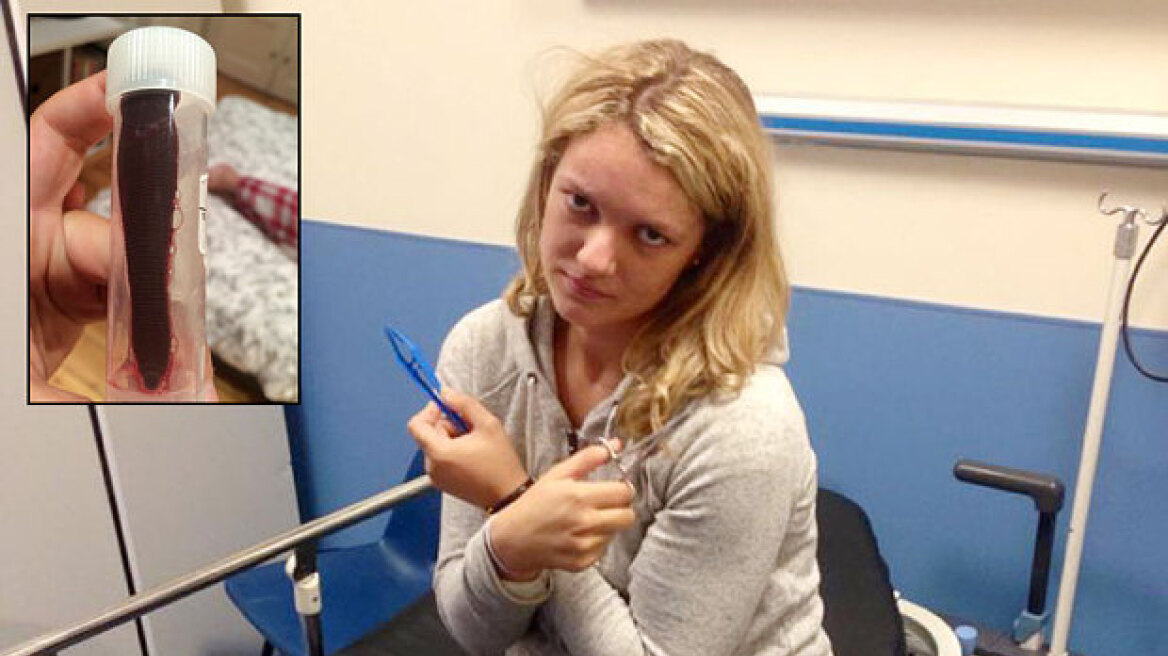 Βρετανία: Ζούσε επί ένα μήνα με μία βδέλλα 7,5 εκ. στη μύτη της!