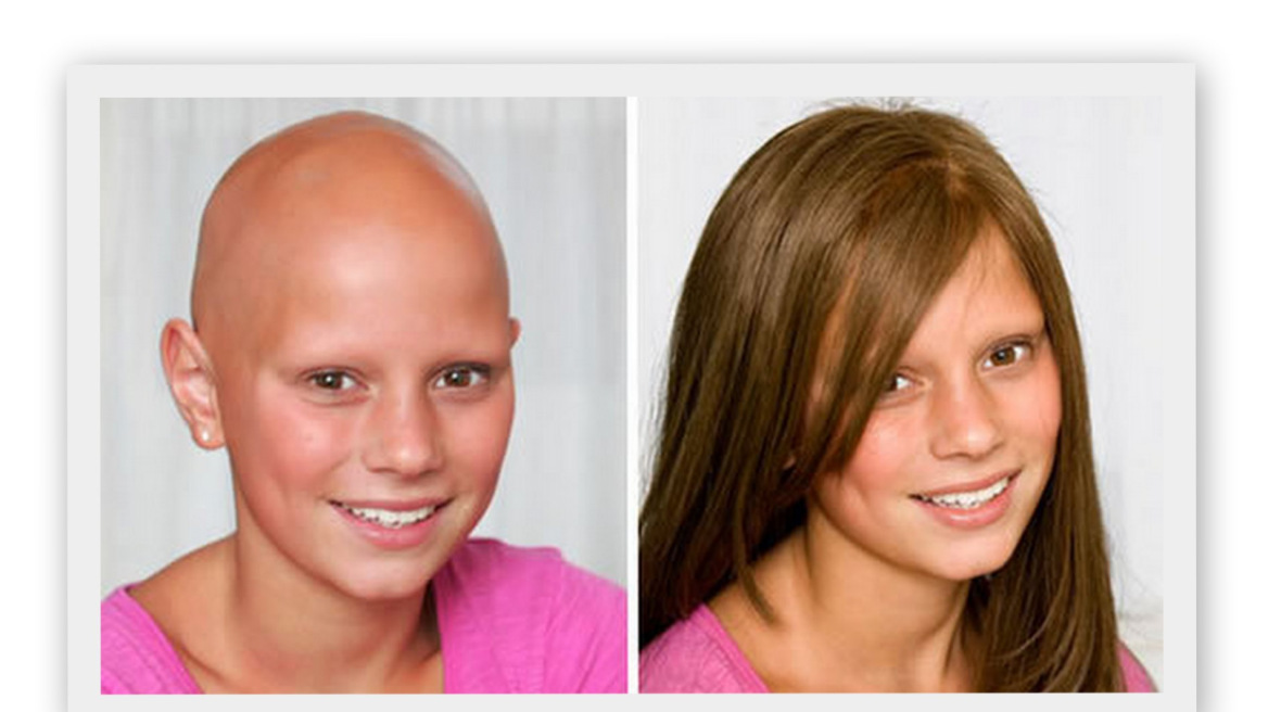 Δωρίστε τα μαλλιά σας για να φτιαχτούν περούκες για καρκινοπαθή παιδιά!	